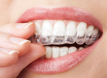 Colocación de placas de retención, férula o hawley en Dental Care Sarrià