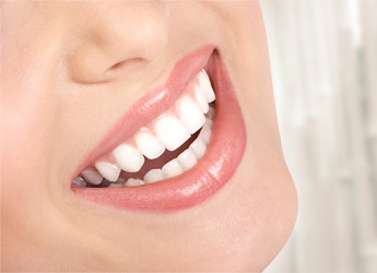 Implantes dentales + Coronas de porcelana en LB Clínicas