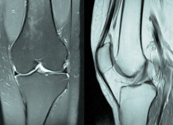 Radiografía de ambas rodillas en Mallorca gracias a Clinic Balear Palma