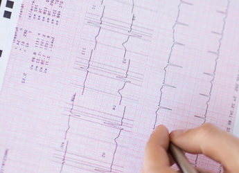 Revisión Cardiológica + Ecocardiograma en Clínica Astarté Cádiz