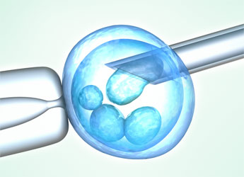 Fecundación in Vitro (FIV) en el Hospital Quirón Valencia 