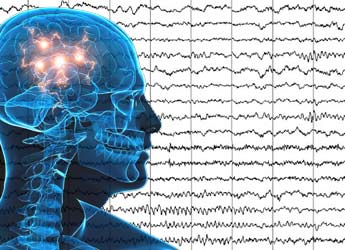 Electroencefalograma (EEG) a precio accesible en Barcelona