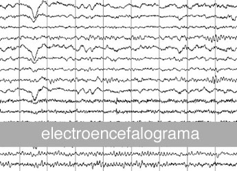 Electroencefalograma (EEG) en el prestigioso Hospital Delfos de Barcelona.