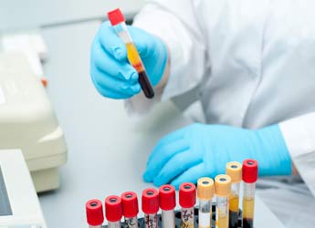 Test de Hormona Anti-Mulleriana (AMH)para Fertilidad Coruña