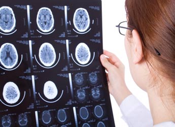 Tac Cerebral o de Cráneo gracias a la Clínica Radiológica Dr. Mario Gallegos