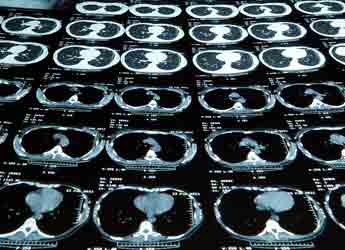 Resonancia Magnética Abierta de 3 regiones anatómicas en Dmi Salud Parla