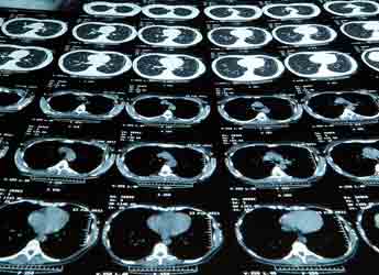 Resonancia Magnética Abierta de 3 regiones anatómicas en Dmi Salud Fuenlabrada