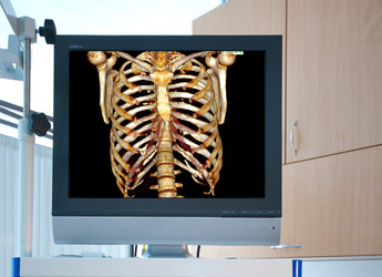 Tac o Tomografía a nivel Óseo de las extremidades en Mataró